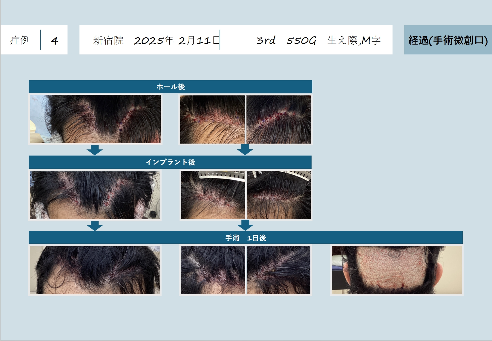 日本临床病例(图5)