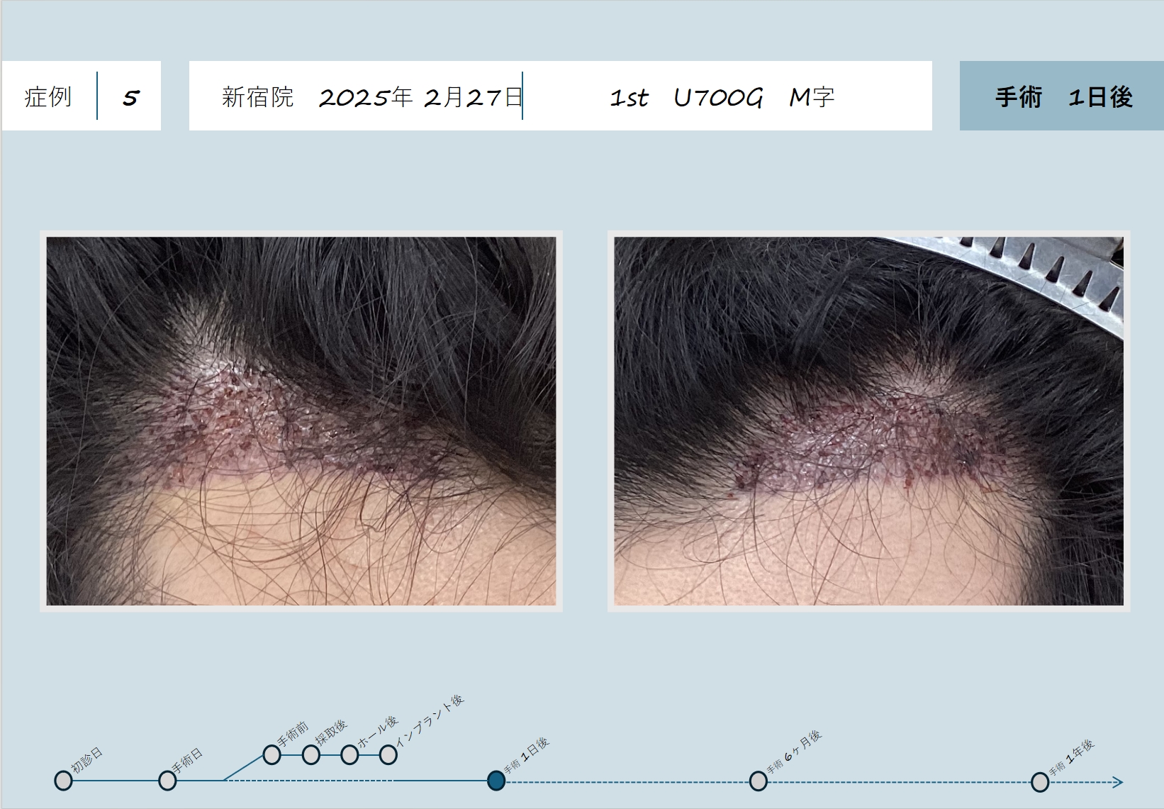 日本临床病例(图6)